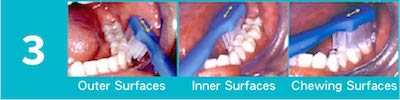 To brush the outer,inner and chewing surfaces of the teeth.