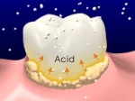 Bacteria in dental plaque will metabolize the sugar to produce acid.